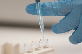Denizli'nin Laboratuvar Testlerinde Marka İsmi: Özel Ünlü Tıbbi Tahlil Laboratuvarı