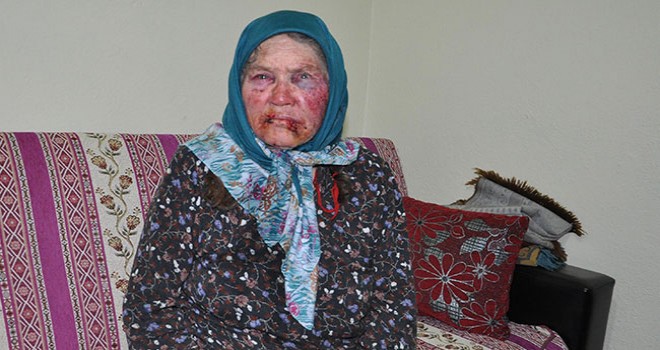 75 yaşındaki kadını boynundaki altın için öldüresiye döven gaspçı kaçtı